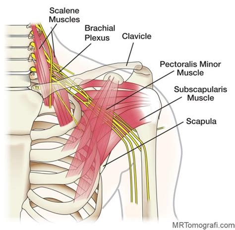 Start studying shoulder impingement syndrome. Brakial Pleksus MR - Nedir, Nasıl Çekilir, Amaçları ve ...