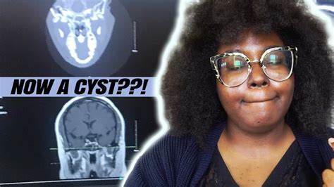 Vlog I Have A Cyst Test Follow Up Beautifulchaos Youtube