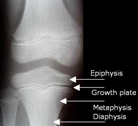 The longitudinal growth of long bones occurs in the epiphyseal plates at their ends. Forensics 101: Epiphyseal Fusion — Jen J. Danna/Sara ...