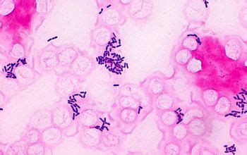 Bureau of microbial hazards, food directorate, health protection branch, health and has demonstrated that gram staining of the gastric aspirate may be a reliable test for early diagnosis of listerial infection (49). Listeria monocytogenes
