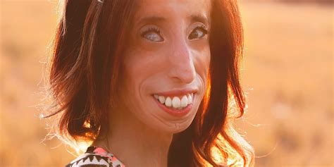 Lizzie Velasquez Fights Bullying With Her New Documentary Fortune
