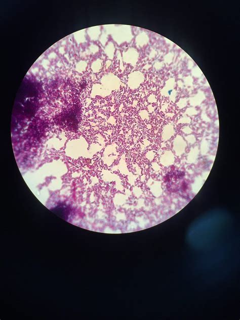 Banthracis Spores Gram Stain Pequenas Coisas Coisas Da Vida