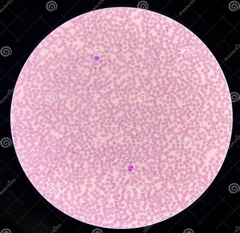 Red Blood Cell And White Blood Cells In 40x Microscope Stock Photo
