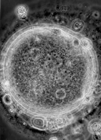 Such a condition is called a dikaryon and the phase is called dikaryophase of fungus. National Museum of Health and Medicine (NMHM ...