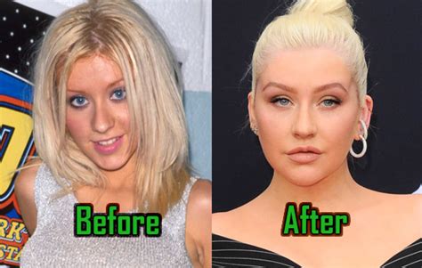 Christina Aguilera Plastic Surgery Did She Really Have It Before After Celebritysurgeryicon