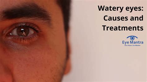 Watery Eyes Causes And Treatments Eyemantra Foundation