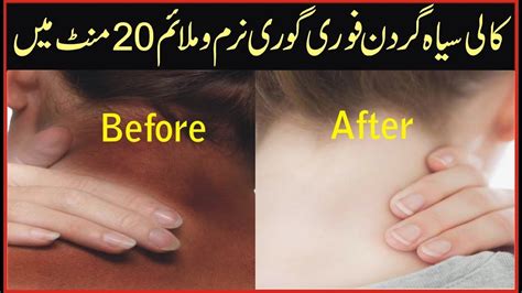 Neck Whitening Neck Care Tips Gardan Gori Karny Ka Trika In Urdu