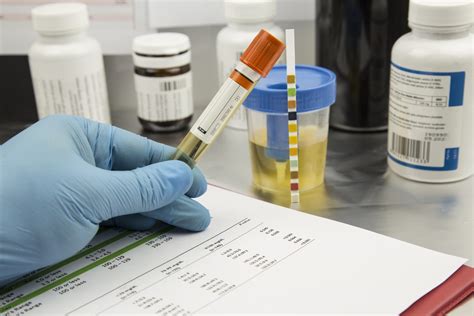 Labcorp Drug Screening Process