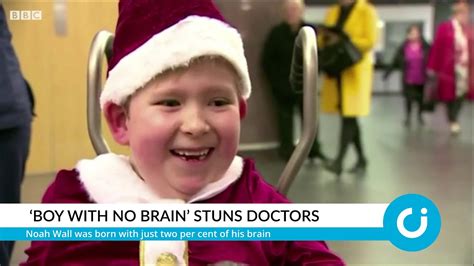 ‘boy With No Brain Stuns Doctors Youtube
