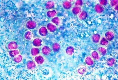 Cryptosporidium species are protozoan parasites that infect the epithelial cells of the gastrointestinal tract of vertebrates. Zoonotic Parasites - Veterinary Technology Vt216 with ...