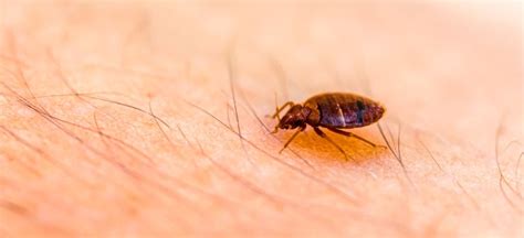 Bed Bug Bites Symptoms Id Treatment How To Get Rid Dr Axe