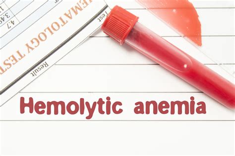 How To Treat Hemolytic Anemia Redorbit