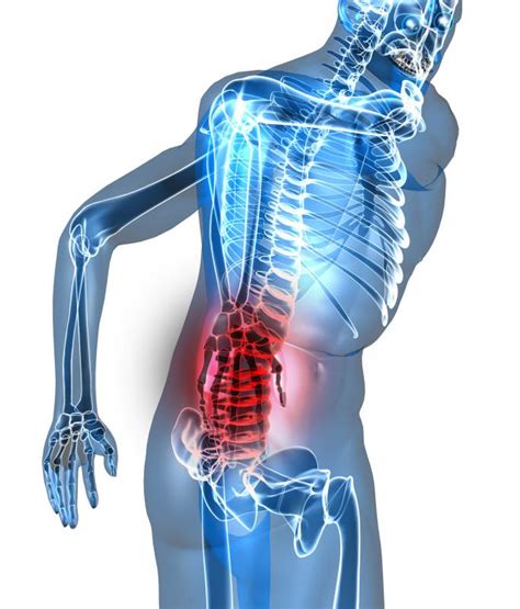 What Are The Most Common Causes Of Leg And Lower Back Pain