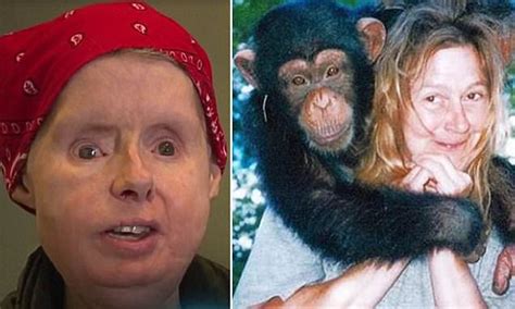 chimpanzee travis victim charla nash s body rejecting face transplant daily mail online