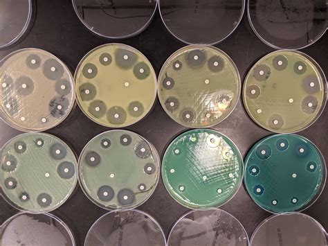 Pseudomonas Aeruginosa Pigments Rmicrobiology