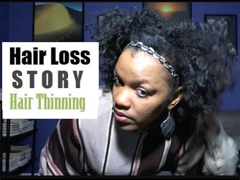 Lack of or inadequate moisture in our hair makes it prone to shedding and breakage; Thinning Hair Loss Story | Hair Shedding & Thin Natural ...