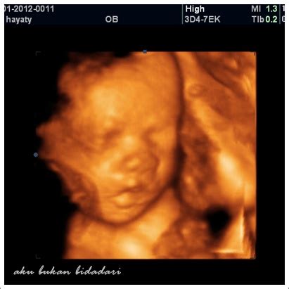 Janji dapat tau pastu doktor print gambar baby tadi. aku bukan bidadari: Diary kehamilan 9 bulan