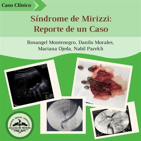 Síndrome de Mirizzi Reporte de un caso Revista Médico Científica