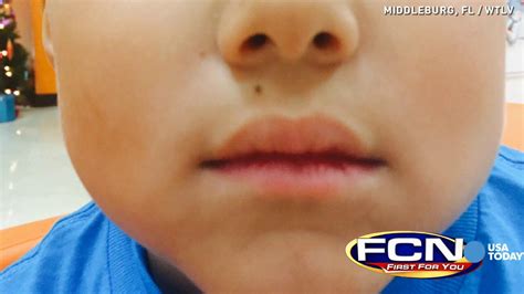 Mom Ymca Worker Duct Taped My Sons Mouth Shut