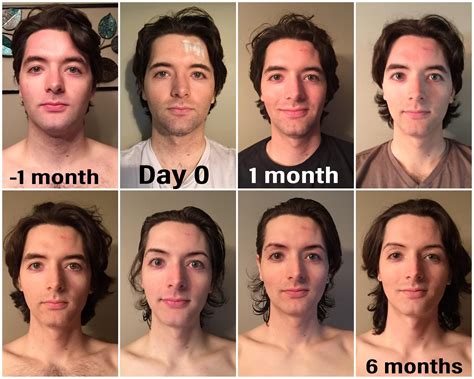 How Long Does It Take To Transition Mtf How To