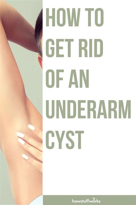 Quick Tips 5 Ways To Treat An Underarm Cyst Cysts 5 Ways Underarm