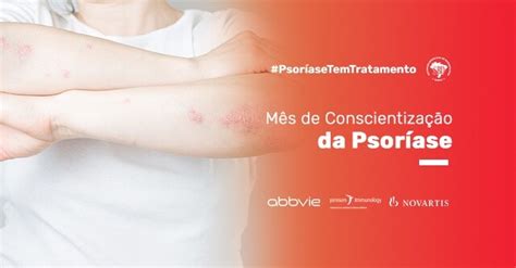 Sociedade Brasileira De Dermatologia Faz Campanha De Conscientização
