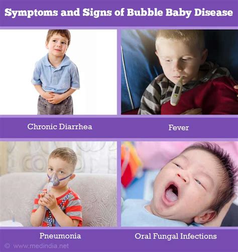 Symptoms And Signs Of Bubble Baby Disease
