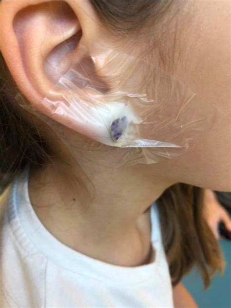 Seven Year Old Rushed To Hospital After Claires Accessories Ear