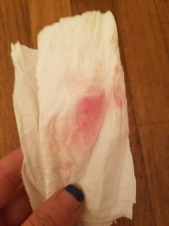Jun 13, 2018 · in most cases, implantation spotting only lasts from a few hours to a couple days, but some women report having implantation spotting for up to seven days. Implantation bleeding or No? Warning photos - BabyCenter