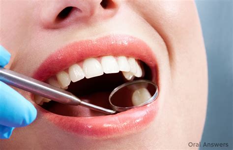 The symptoms of a cavity will depend on how large it is and where it is in your mouth. Six Common Places Where You Might Get a Cavity | Oral Answers