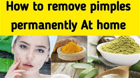 Truth About How To Remove Pimples Permanently At Home Simple Pimples