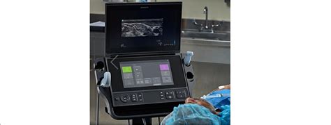 Fujifilm Sonosite Launches New Point Of Care Ultrasound System