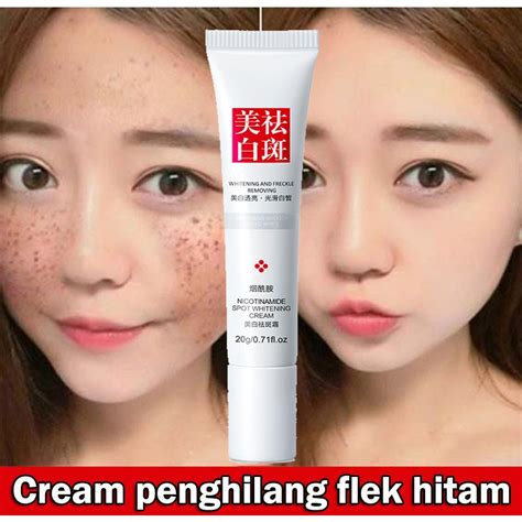 Jual YZKMSKIN CINDYNAL Whitening Freckle Remove Dark Spots Cream