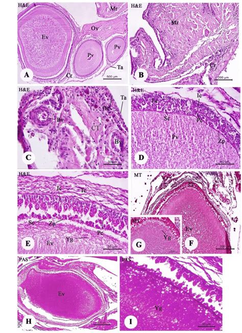 Light Photomicrographs Of Ovaries With Previtellogenic And Early
