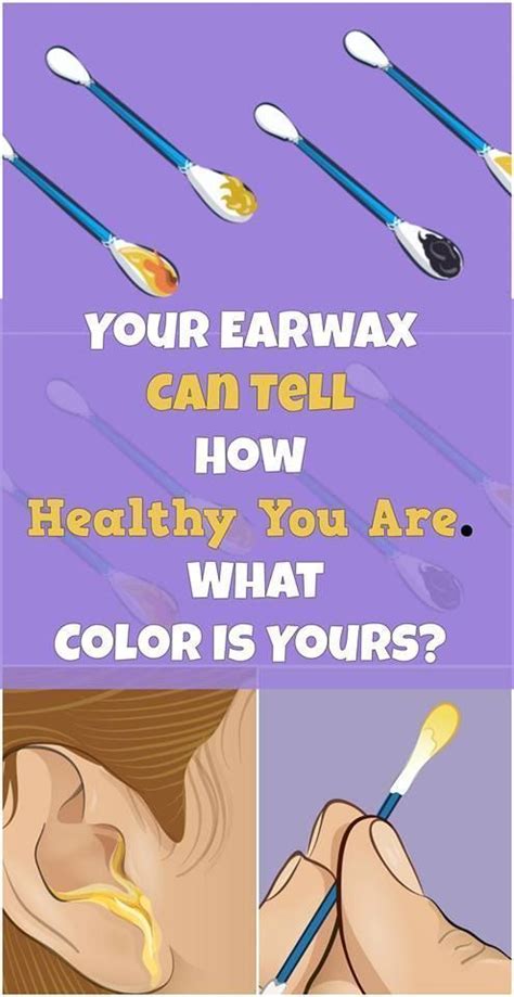 Did You Know That The Color Of Your Earwax Can Reveal How Healthy You