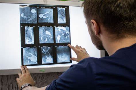 Очаговый гастрит лечения диета Очаговый атрофический гастрит желудка: симптомы и лечение – ЭЛ Клиника Очаговый атрофический гастрит желудка: симптомы и лечение – ЭЛ Клиника Очаговый гастрит лечения диета