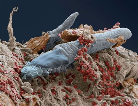 In commensalism, one species benefits, while the other is neither harmed nor helped. The body: The great skin safari | New Scientist