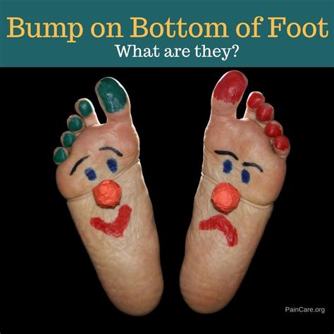 If you've noticed a lump on the top of your foot, you most likely did a quick assessment, perhaps considering such questions as Knotty lump & Bump On Bottom of Foot - What Are They ...
