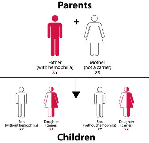 Hemophilia Inheritance Patterns X Chromosomes Mutation