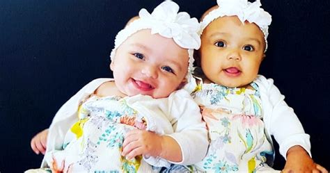 meet biracial twin girls with different skin colours break the internet welcome