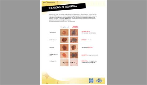 Find Skin Cancer Early Know Your Abcdes Infographic D