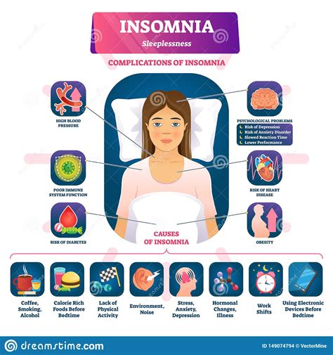 Insomnia Vector Illustration. Labeled Sleeplessness ...