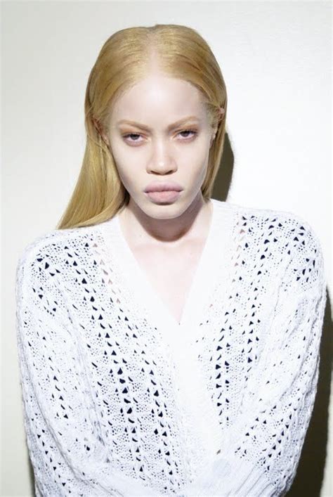Just A Few Things That I Find To Be Beautiful Albino Model Black