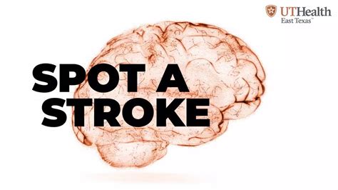 How To Spot A Stroke Youtube