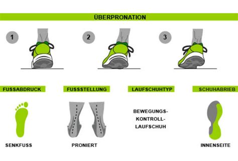 Kommt noch ein knickfuß dazu, kann das zu schmerzen am fuß und knöchel führen, da der fuß leicht zur seite knickt. Pronation: Tipps & Infos im Online Magazin »Joggen Online«