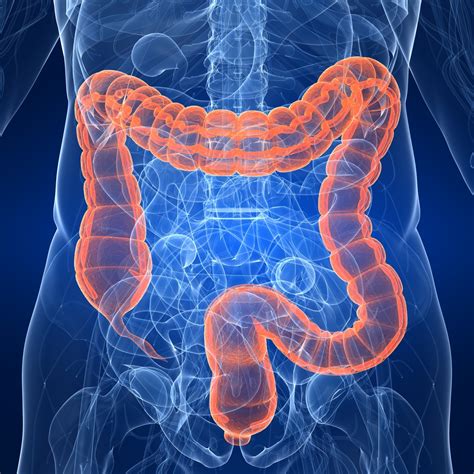Avoid Colorectal Cancer By Early Screening Continental Hospitals Blog