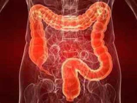 The appendix (or vermiform appendix) is a winding tube that attaches to. large intestine Cleansing ( part 62 ).wmv - YouTube