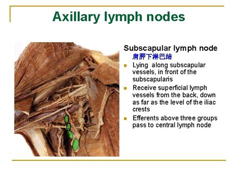 Supraclavicular Lymph Nodes Wikipedia