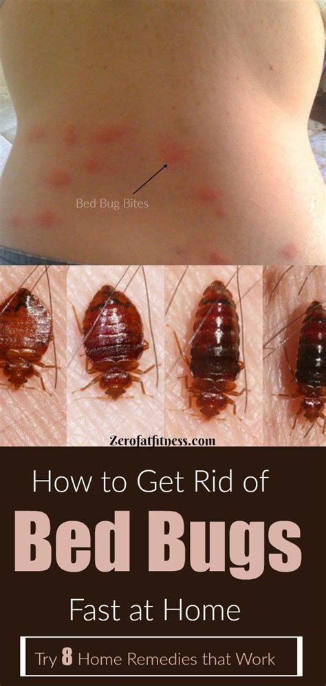 How Can You Tell If Its A Bed Bug Whatodi