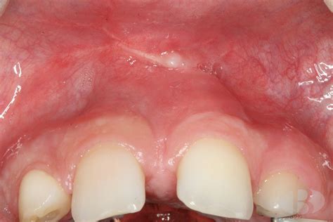 Simple Science: How to Make a Volcano with Kids